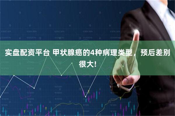 实盘配资平台 甲状腺癌的4种病理类型，预后差别很大!